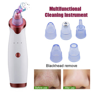 Cleanser for Acne - Acne Remover - Face cleaning - Vacuum Extractor Tool Pro