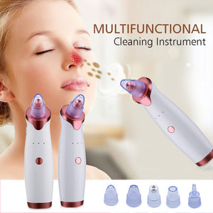 Cleanser for Acne - Acne Remover - Face cleaning - Vacuum Extractor Tool Pro