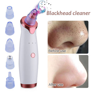 Cleanser for Acne - Acne Remover - Face cleaning - Vacuum Extractor Tool Pro